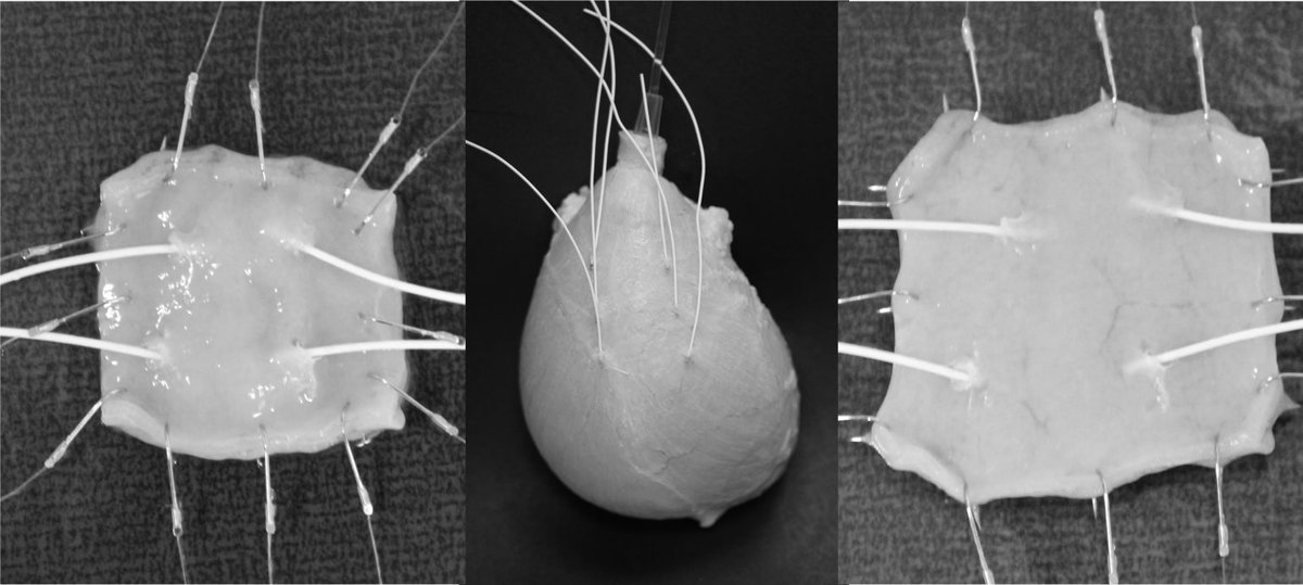 Bladder tissue